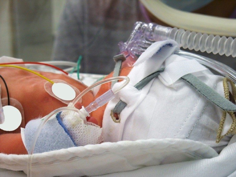 C-Sections to Prevent Hypoxic-Ischemic Encephalopathy (HIE)