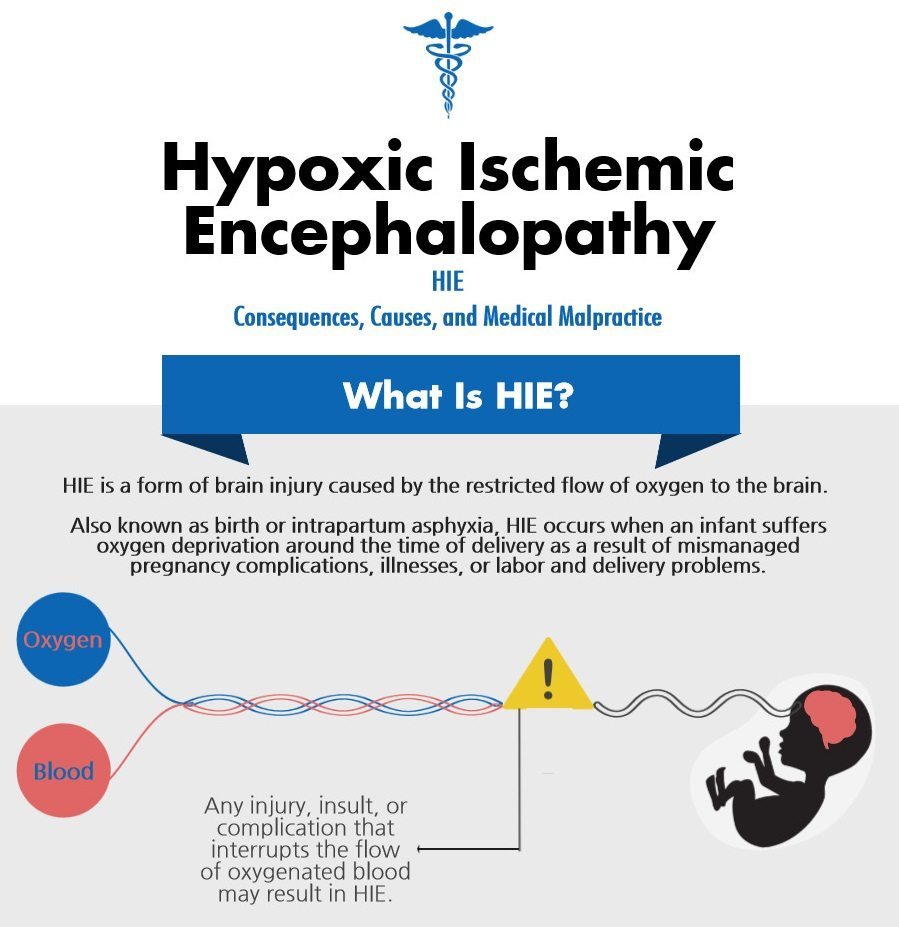 C-Sections to Prevent Hypoxic-Ischemic Encephalopathy (HIE)